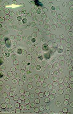 Candida Images - Photos - Pictures - CrystalGraphics